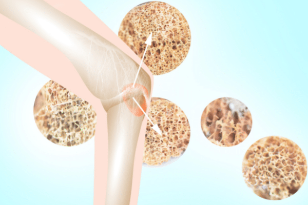 How can I strengthen my bones?